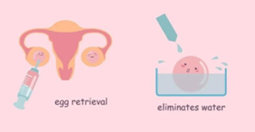 月子里供卵宝宝便秘的成因与应对策略